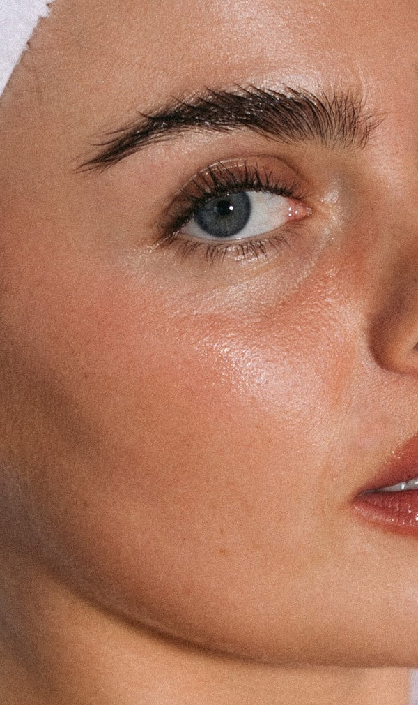 Dark Spots